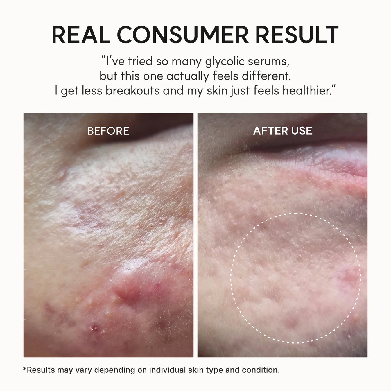 Eraser Shot Glycolic Acid Booster