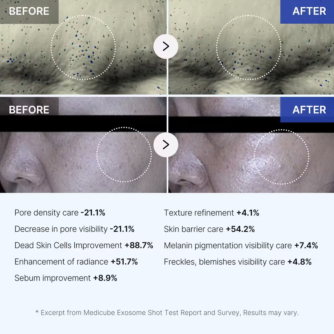 One Day Exosome Shot Pore Ampoule 2000