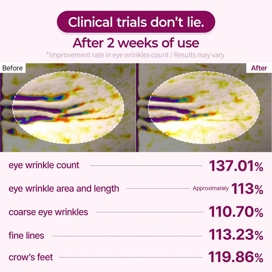 Cemenrete Calcium Volume Eye Patch