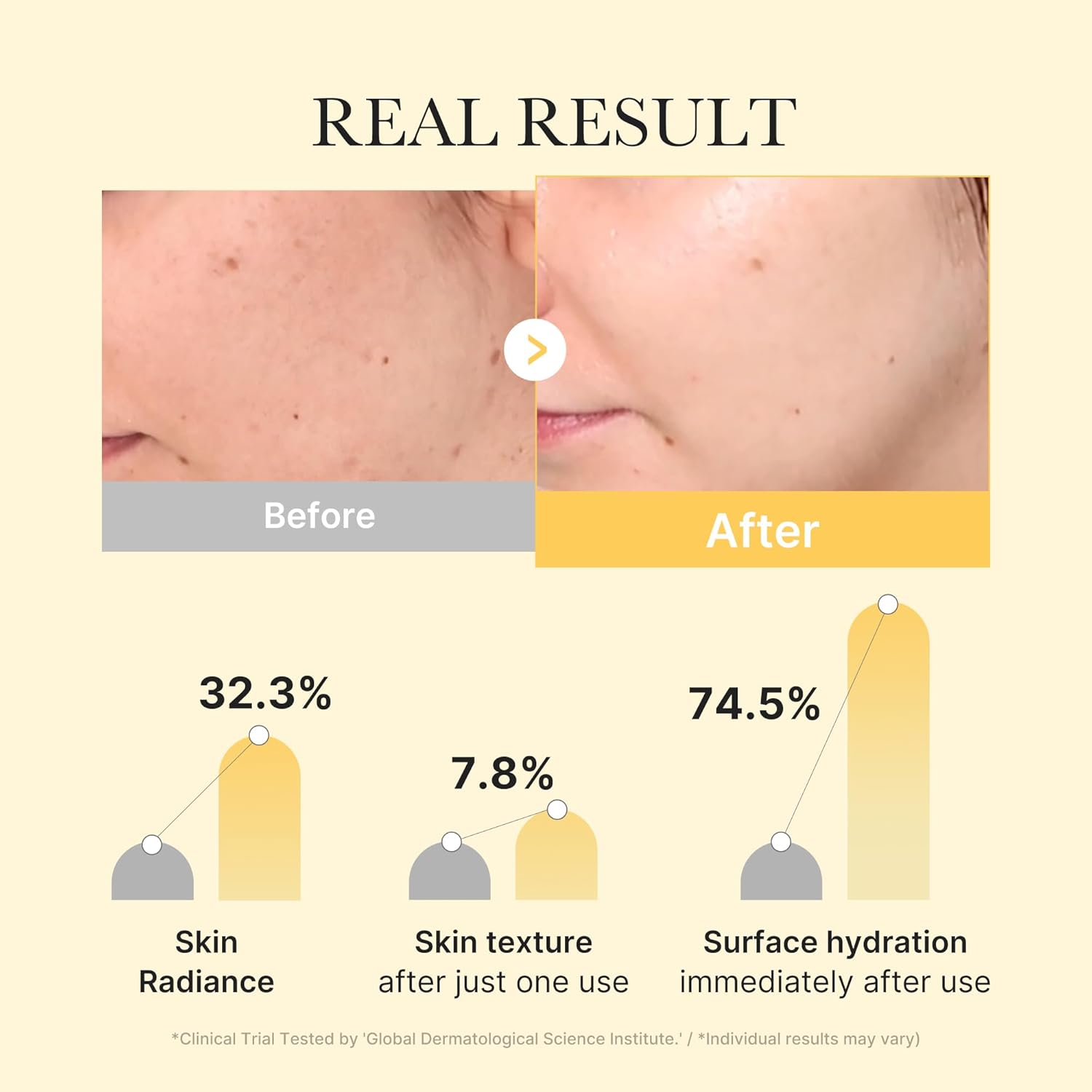 Kojic Acid Turmeric Brightening Gel Mask (4ea)