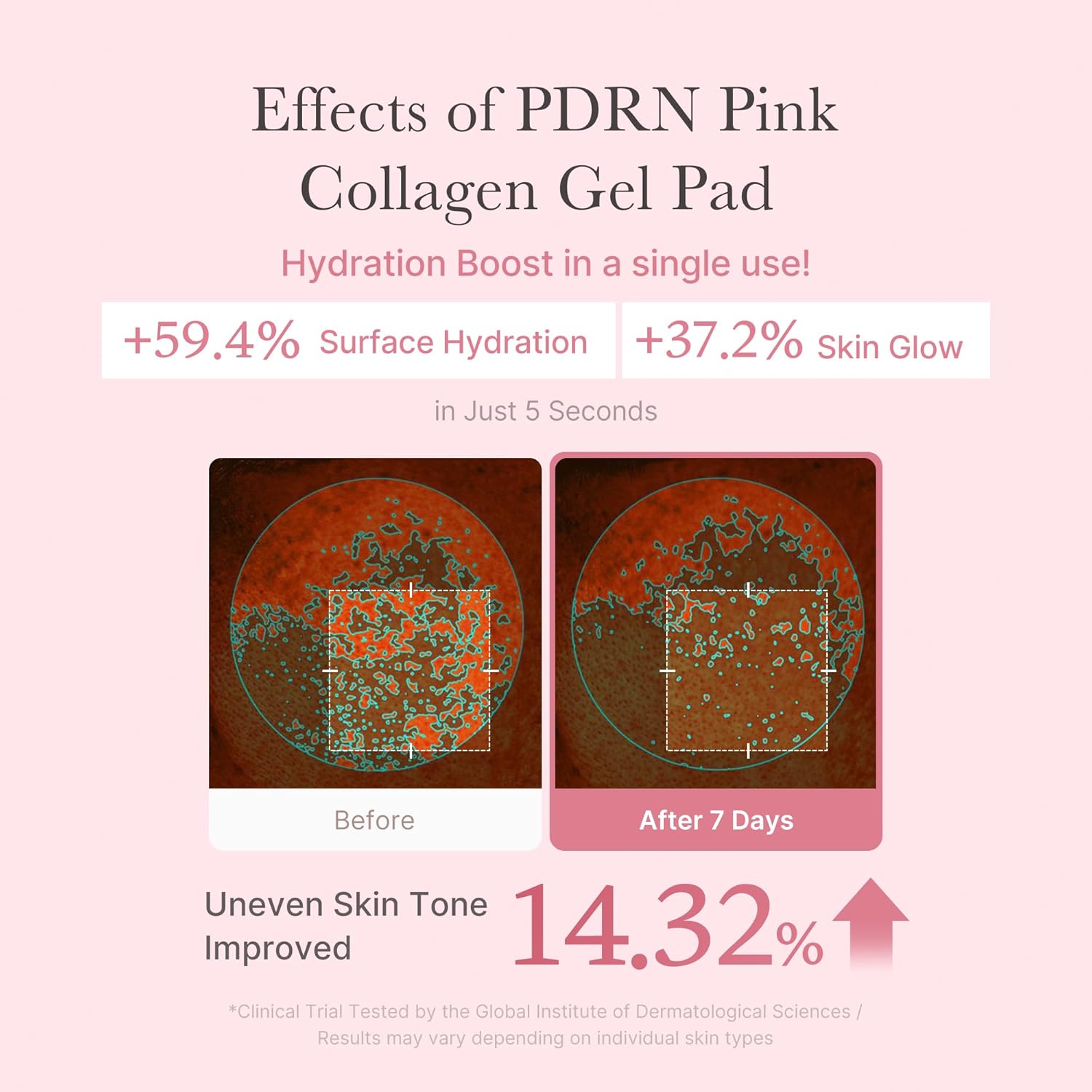 PDRN Pink Collagen Toning Gel Toner Pad (70pcs)