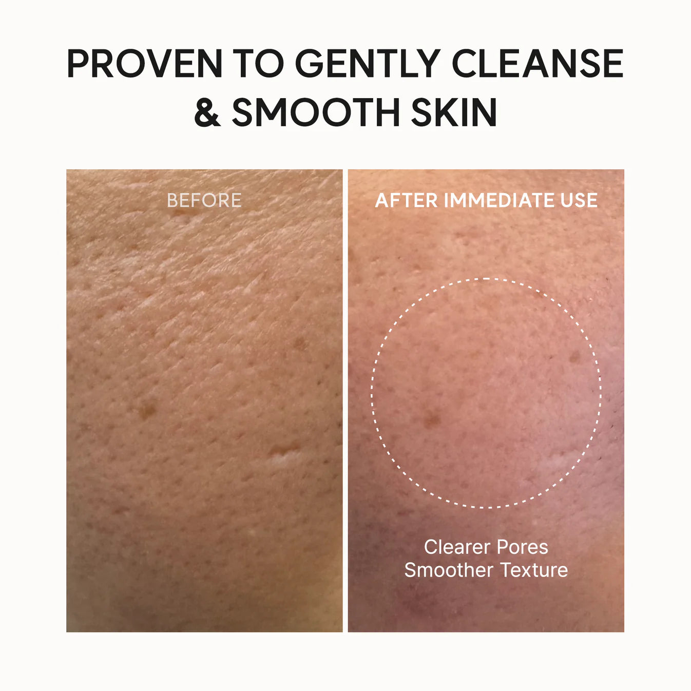 Fresh Rosehip Rice Mochi Cleanser